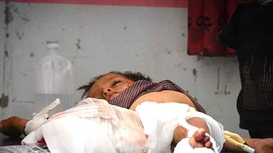 اليونيسيف: مقتل 17 طفلا يمنيا خلال 20 يوميا - أرشيف