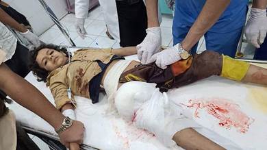 من ضحايا القصف الحوثي