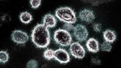 
صورة مجهرية لفيروس كورونا المسبب لمرض "كوفيد-19"
