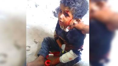 مقذوف من مخلفات الحوثي ينفجر بطفل في كرش