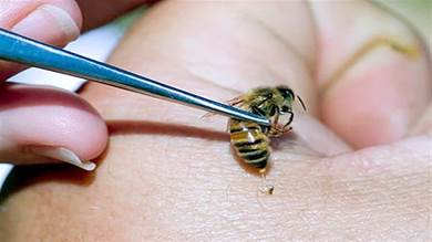 طبيب بيطري يمني ينجح في علاج المرضى بلسعات النحل