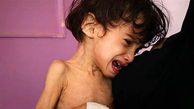 ​مركز أبحاث: الصراع بشكله الحالي في اليمن يقود إلى مجاعة محققة