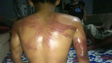تعذيب وحشي لطفل في شرطة زنجبار