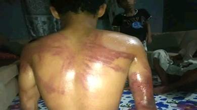 ​فتح تحقيق في تعذيب طفل بأحد أقسام شرطة زنجبار