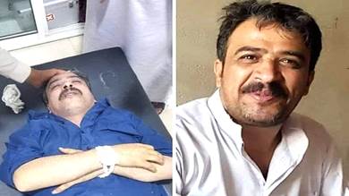 ​وفاة مواطن تعرض للتعذيب في سجن بصنعاء