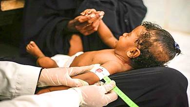 2.2 مليون طفل يمني سيواجهون الموت قبل نهاية العام