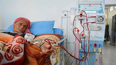 صنعاء للأمم المتحدة: نحن أمام كارثة تتهدد حياة 5 آلاف مريض بالفشل الكلوي
