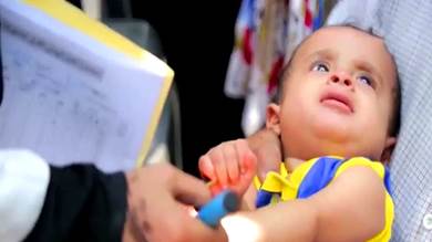 وزارة الصحة تسجيل 228 حالة جديدة بشلل الأطفال