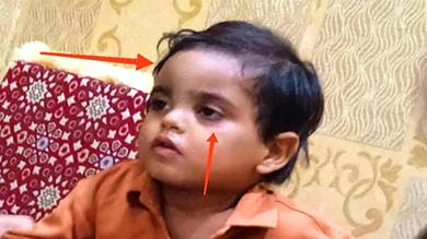 الطفل عبدالله حمزة وعلى عينه ورأسه علامات التعذيب