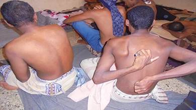 لحج.. إصابة 63 سجينا بالرمد والجرب وأمراض جلدية معدية