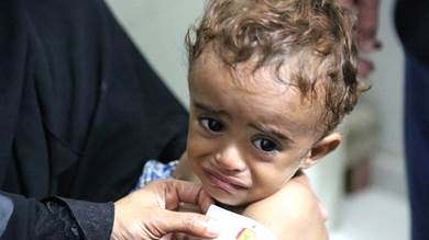الأمم المتحدة: 10 ملايين طفل يمني بحاجة إلى الدعم المنقذ للحياة