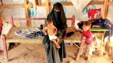 تقرير لمنظمة دولية: كل 10 دقائق يموت طفل في اليمن جوعا