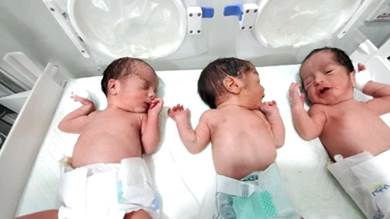 لأول مرة في مستشفى مأرب.. حالة ولادة نادرة لـ 3 أطفال توأم