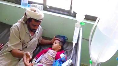 ​تحذّير أممي من تفشي وباء قاتل في اليمن