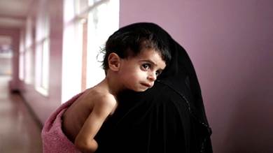 ​منحة بريطانية بـ 31 مليون دولار لدعم صحة وتغذية الأطفال والنساء باليمن